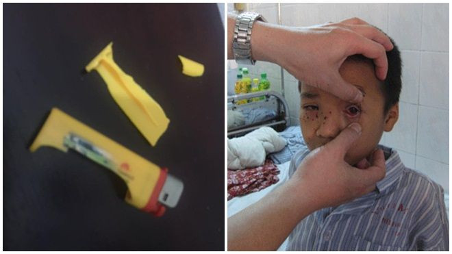 Hiểm họa khôn lường từ những chiếc bật lửa giá rẻ tự phát nổ Ảnh 2