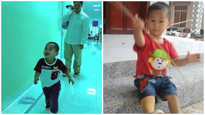 Bé trai 'văng khỏi bụng mẹ' chạy trên chân giả ở tuổi lên 2 Ảnh 2