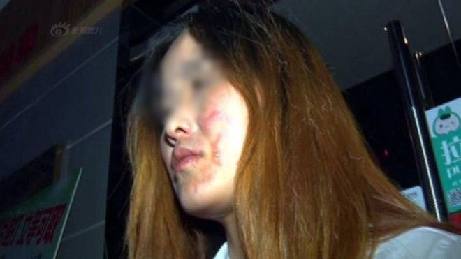 Trung Quốc: Đi ăn lẩu, cô gái bất ngờ bị nhân viên cửa hàng làm cháy mặt Ảnh 2