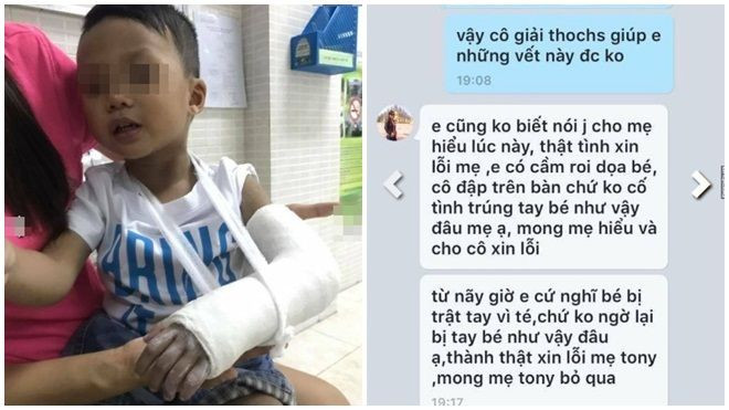 Nghi vấn giáo viên mầm non đập bàn 'vô tình' làm gãy tay bé trai 3 tuổi Ảnh 2