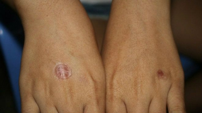 Nữ sinh run sợ kể phút bị bạn châm thuốc lá vào tay, bắt liếm chân Ảnh 2