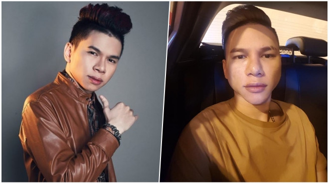 Hoàng Tôn: 'Tôi không hối hận khi phẫu thuật thẩm mỹ mà tiếc… vì tin nhầm bác sĩ' Ảnh 2