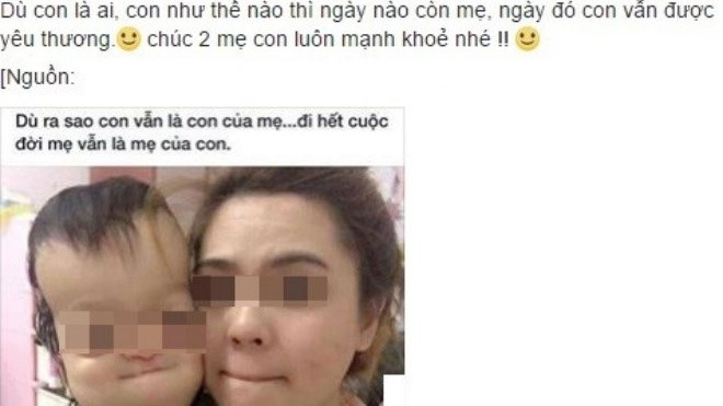 Ảnh mẹ trẻ và con tật nguyền: Tình mẫu tử thiêng liêng Ảnh 2