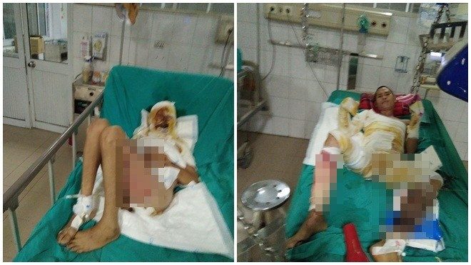 Vụ nổ bốt điện Hà Đông: Nạn nhân chỉ còn 1% hi vọng sống Ảnh 2