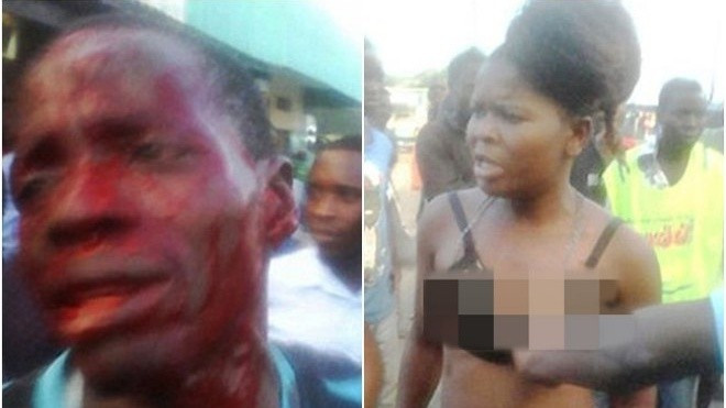 Chàng trai bị gái mại dâm đánh chảy máu đầu vì trả công bằng một quả trứng luộc Ảnh 2