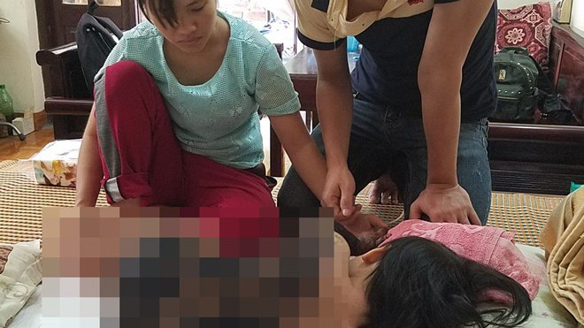 Tình người cứu sống bé gái 3 tuổi bỏng kín lưng Ảnh 2