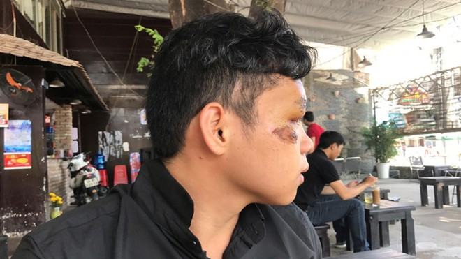 Nam sinh thoát chết thần kỳ dưới gầm xe: 'Ngỡ đã ở thế giới khác!' Ảnh 2