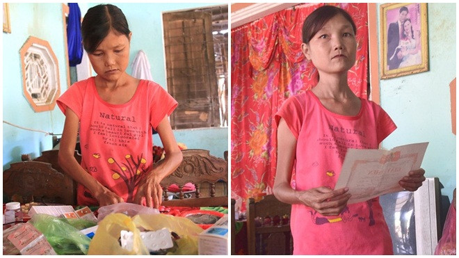 Cô gái mang khuôn mặt bà lão ở Quảng Nam: Ăn gấp 10 lần người thường, uống mỗi ngày 36 lít nước Ảnh 2