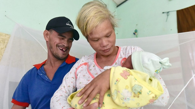 Chồng khoèo và vợ câm điếc, tổ ấm hạnh phúc của họ khiến bao người ngưỡng mộ Ảnh 2