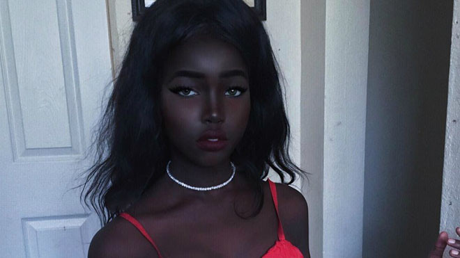 Cô gái bỗng nổi tiếng trên mạng nhờ làn da đen kỳ lạ Ảnh 2