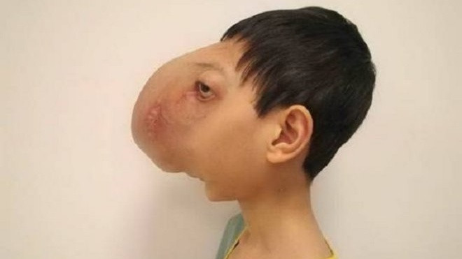 Thay đổi diệu kỳ của chàng trai Việt 'không có mặt' qua 4 cuộc phẫu thuật của giáo sư Mỹ Ảnh 2