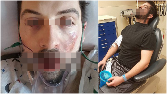 Mất răng vì hút thuốc lá điện tử: Lời cảnh tỉnh cho các tín đồ của Vape Ảnh 2