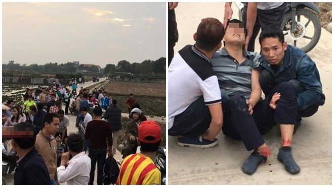 Mặc kệ còi báo hiệu, người đàn ông vẫn cố tình băng qua đường ray tàu hỏa và cái kết 'đắng' Ảnh 2