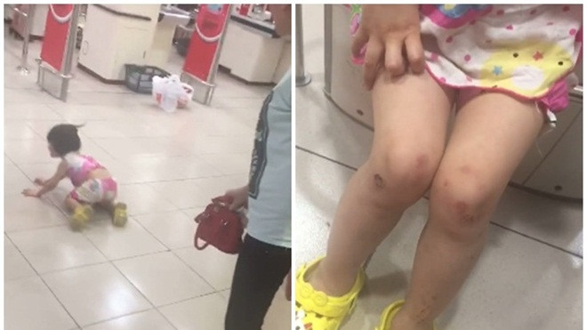 Hà Nội: Bé gái bị mẹ dùng túi đánh mạnh vào mặt vì làm mất một gói kẹo trong siêu thị Ảnh 2
