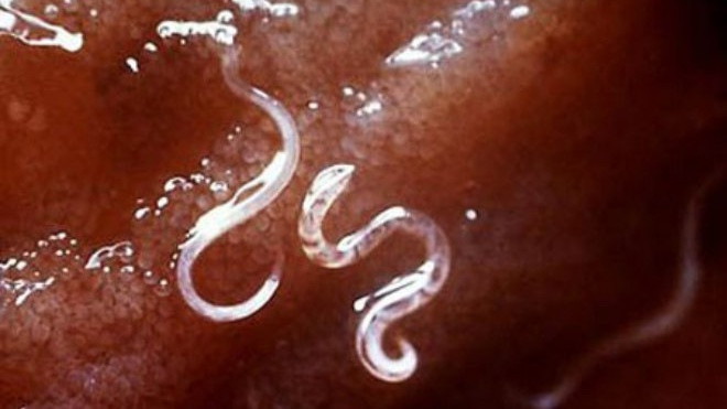 Giun làm tổ trong não người đàn ông hay chơi cùng chó mèo Ảnh 2