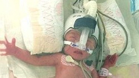 Vừa sinh con trai được 7 ngày, người mẹ lại vào phòng đẻ 2 đứa con nữa Ảnh 2