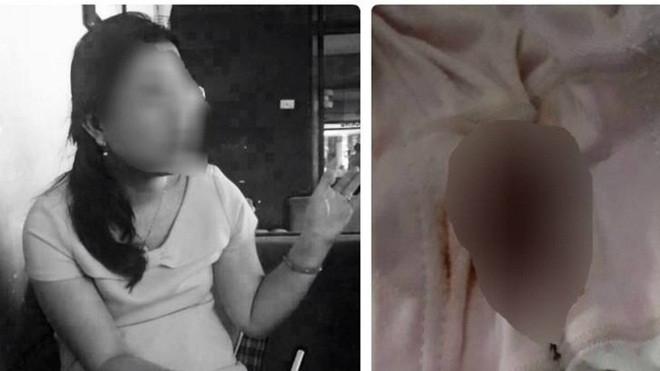 Báo cáo của Phòng giáo dục quận Thủ Đức: Bé lớp 1 bị té nên chảy máu, không bị xâm hại Ảnh 2