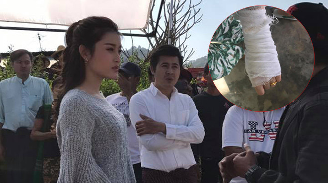 Sự thật về chấn thương của Á hậu Huyền My khi quay hình tại Myanmar Ảnh 2
