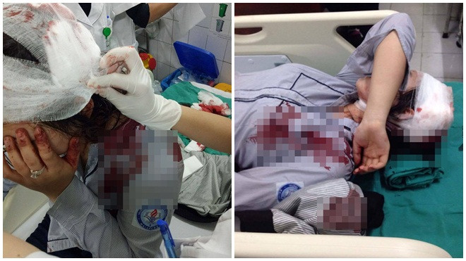 Hà Nội: Trả thù nhầm, 3 thanh niên hành hung dã man nữ sinh THPT Ảnh 2