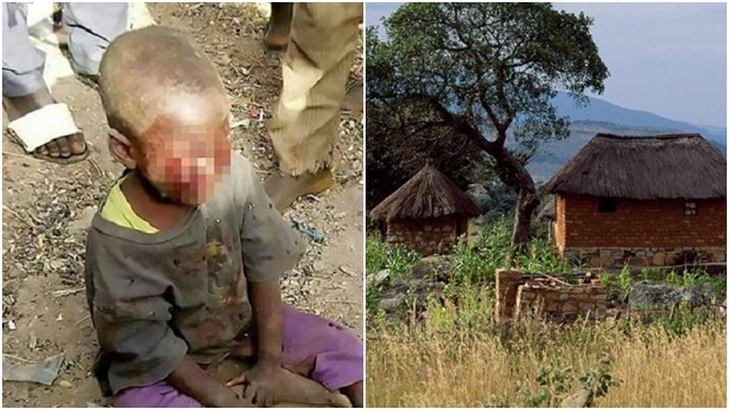 Mẹ kế bạo hành con chồng 4 tuổi vì tè dầm Ảnh 2