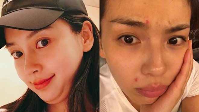 Angela Baby bất ngờ đăng ảnh lộ hai cằm, Lưu Đào khổ sở với mặt mụn Ảnh 2