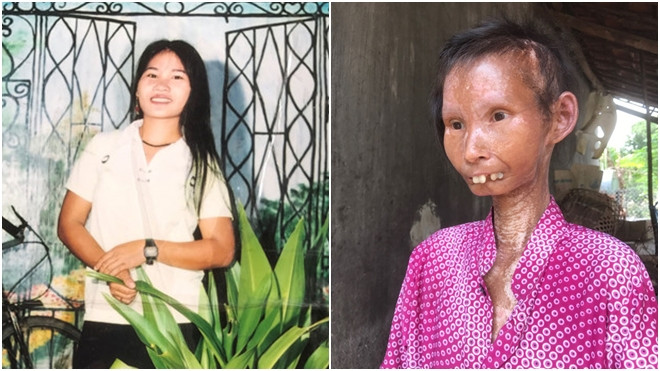 Nàng sơn nữ biến thành bà già vì bệnh lạ Ảnh 2