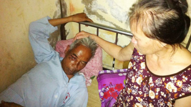 Hai cô gái tông cụ ông ngất xỉu rồi đưa ra bỏ ở… nghĩa trang? Ảnh 2