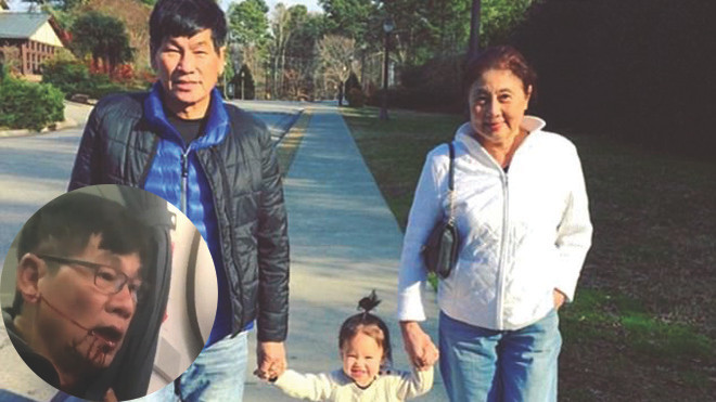 Bác sĩ bị kéo lê trên máy bay United Airlines là người Mỹ gốc Việt Ảnh 2