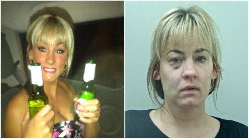 Uống 3 chai rượu mỗi ngày suốt mười năm và kết quả là đây Ảnh 2