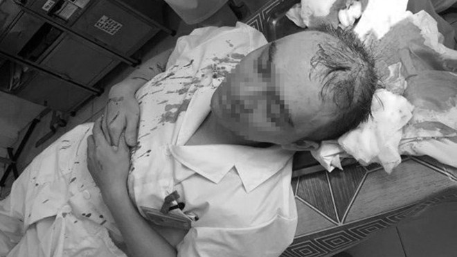 HN: Bác sĩ bị đánh bất tỉnh, theo dõi chấn thương sọ não Ảnh 2