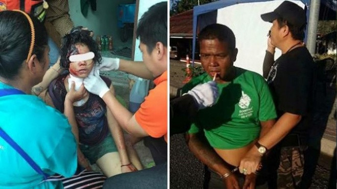 Bé gái 13 tuổi bị cha ruột hành hung vì dành quá nhiều thời gian cho mạng xã hội Ảnh 2