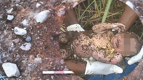 Bị mẹ ruột chôn sống ba ngày, bé sơ sinh sống sót một cách kỳ diệu Ảnh 2