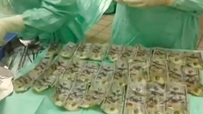 Cãi nhau với chồng, vợ nuốt chửng 7.000USD để giấu tiền Ảnh 2