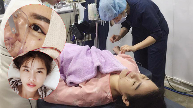 Quế Vân công khai phẫu thuật thẩm mỹ: 'Đẹp phải khoe, xấu mới che' Ảnh 2