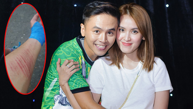 Tú Vi xót xa khi Văn Anh bị ngã rách tay, trầy trụa khắp người Ảnh 2