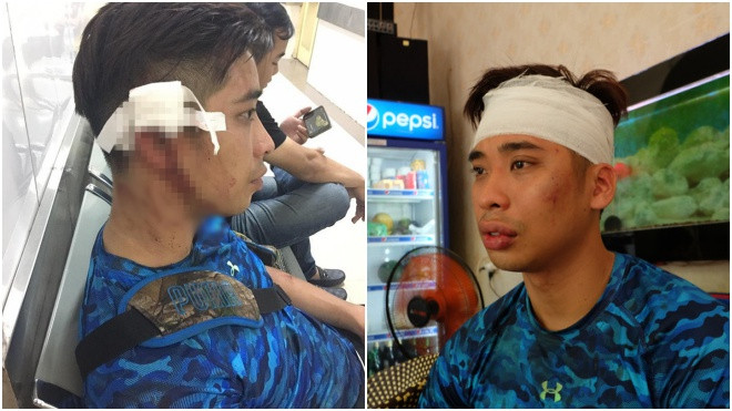 Dẫn bạn gái đi tập tại trung tâm fitness nổi tiếng, nam khách hàng '6 múi' bị hành hung dã man Ảnh 2