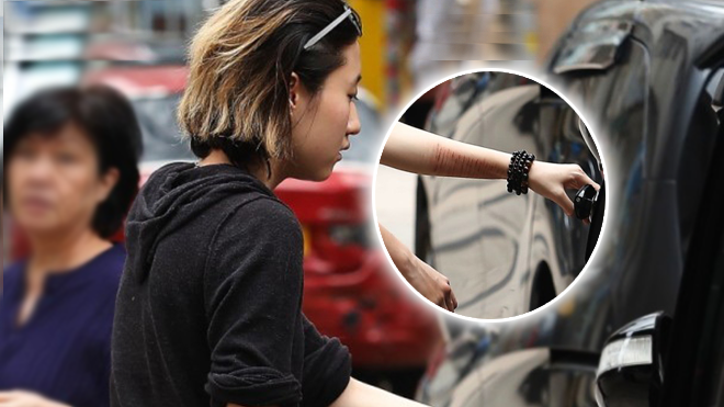 Tự tử không thành, con rơi Thành Long xuất viện với sẹo vết đầy tay Ảnh 2