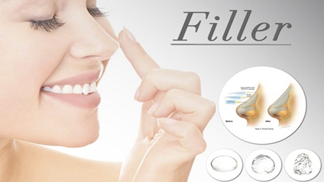 Giới trẻ đổ tiền bơm Filler: Đừng để đau mới thấu! Ảnh 2