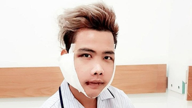Mới qua giai đoạn 1, diện mạo 'khang khác' của Tùng Sơn đã khiến dân mạng ngỡ ngàng Ảnh 2
