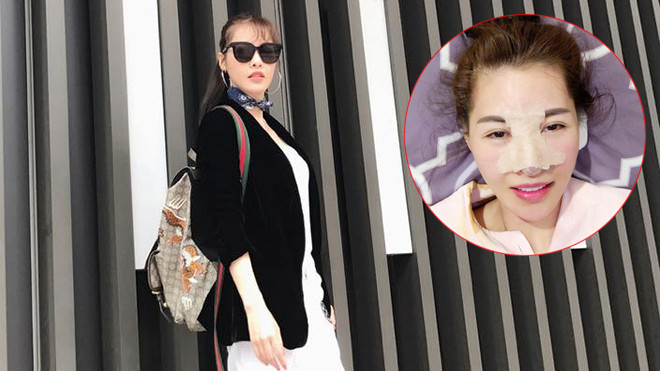 Chưa hài lòng nhan sắc, Quế Vân lại chi 400 triệu đồng sang Hàn Quốc 'đập mặt' lần hai Ảnh 2