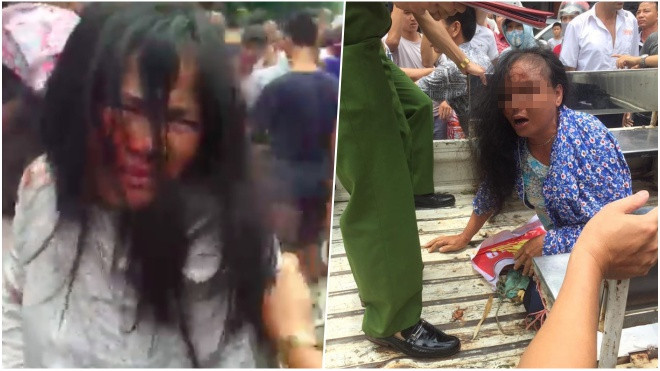 Thêm một vụ hiểu lầm bắt cóc, 2 phụ nữ bị đánh nhập viện Ảnh 2