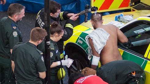 Lại có thêm một vụ tấn công bằng axit ở Anh khiến hai thanh niên bị bỏng nặng Ảnh 2