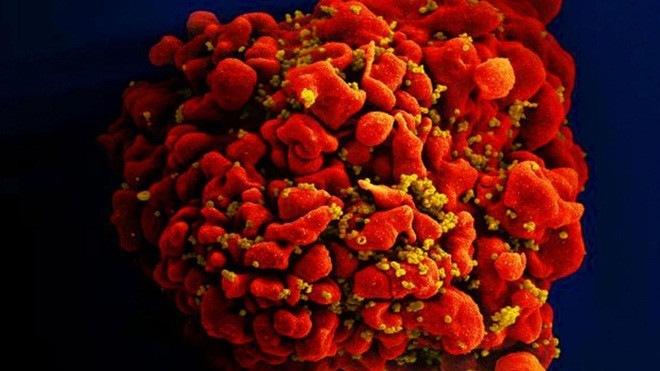 Ca nhiễm HIV thứ 3 trên thế giới được chữa khỏi Ảnh 2