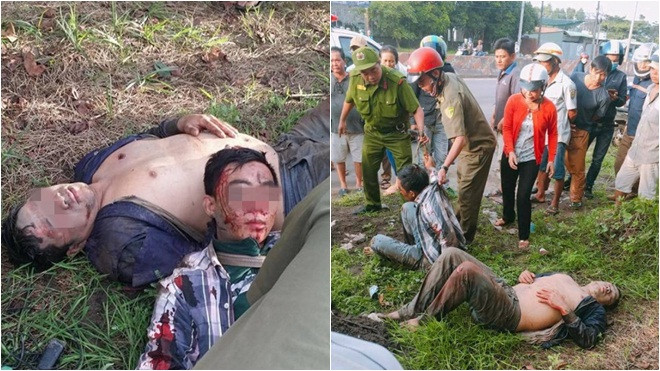 Trộm chó bị đánh vỡ sọ nhiễm HIV, bệnh viện Đồng Nai kêu gọi người đánh đi khám phơi nhiễm Ảnh 2