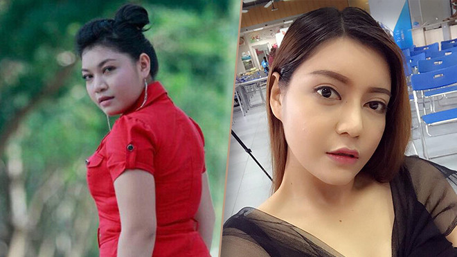 Đâu chỉ Đức Phúc, Xuân Nghi The Voice cũng xinh đến 'giật mình' nhờ phẫu thuật thẩm mỹ Ảnh 2