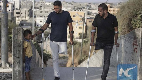 Câu chuyện tình bạn cảm động: 2 người đàn ông cụt chân và đi chung với nhau 1 đôi giày Ảnh 2