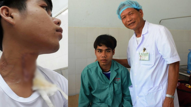 Quảng Nam: Đang chơi đùa gần nhà, nam thanh niên bị trâu húc rách khí quản Ảnh 2