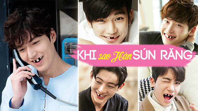 'Soái ca' phim Hàn sẽ ra sao nếu bị… sún răng Ảnh 2