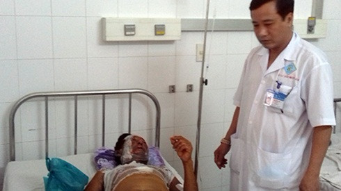 11 khách ăn cưới bỏng nặng do bếp cồn bùng cháy Ảnh 2