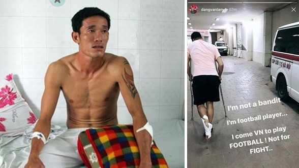 6 vụ cầu thủ Việt bị rượt chém gây rúng động làng bóng đá Ảnh 2